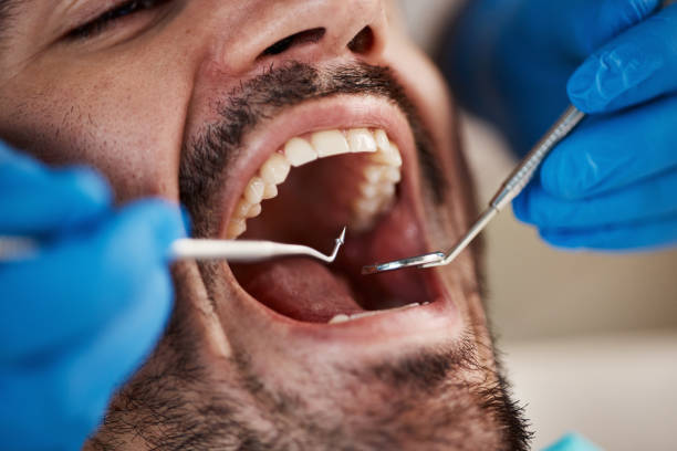 Best Emergency Dentist for Knocked-Out Tooth in Union City, MI