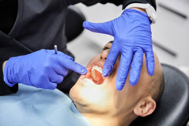 Best Emergency Dental Extractions in Union City, MI